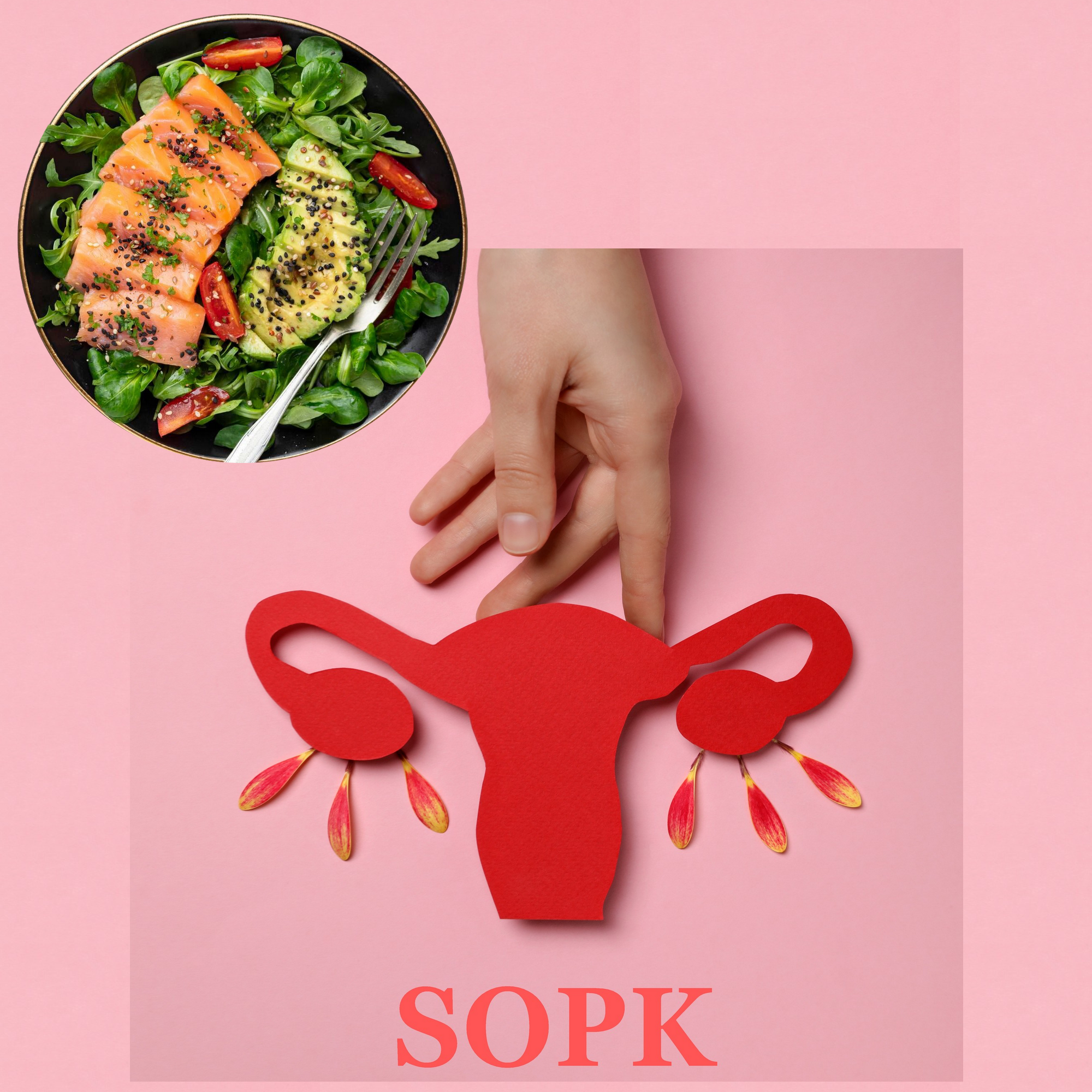 Consultation sopk - Prise en charge nutritionnelle
